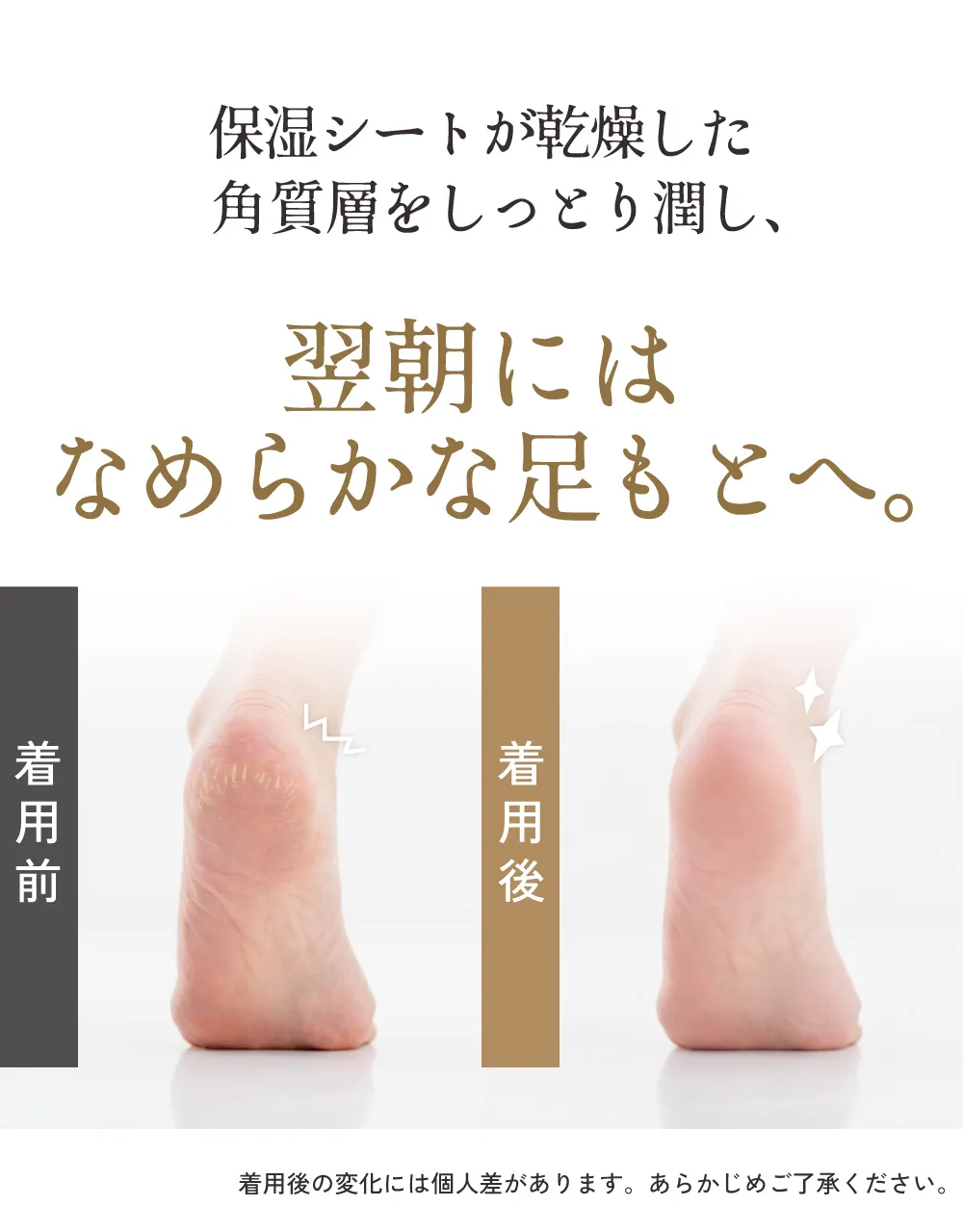 かかと革命│翌朝にはなめらかな足元へ。